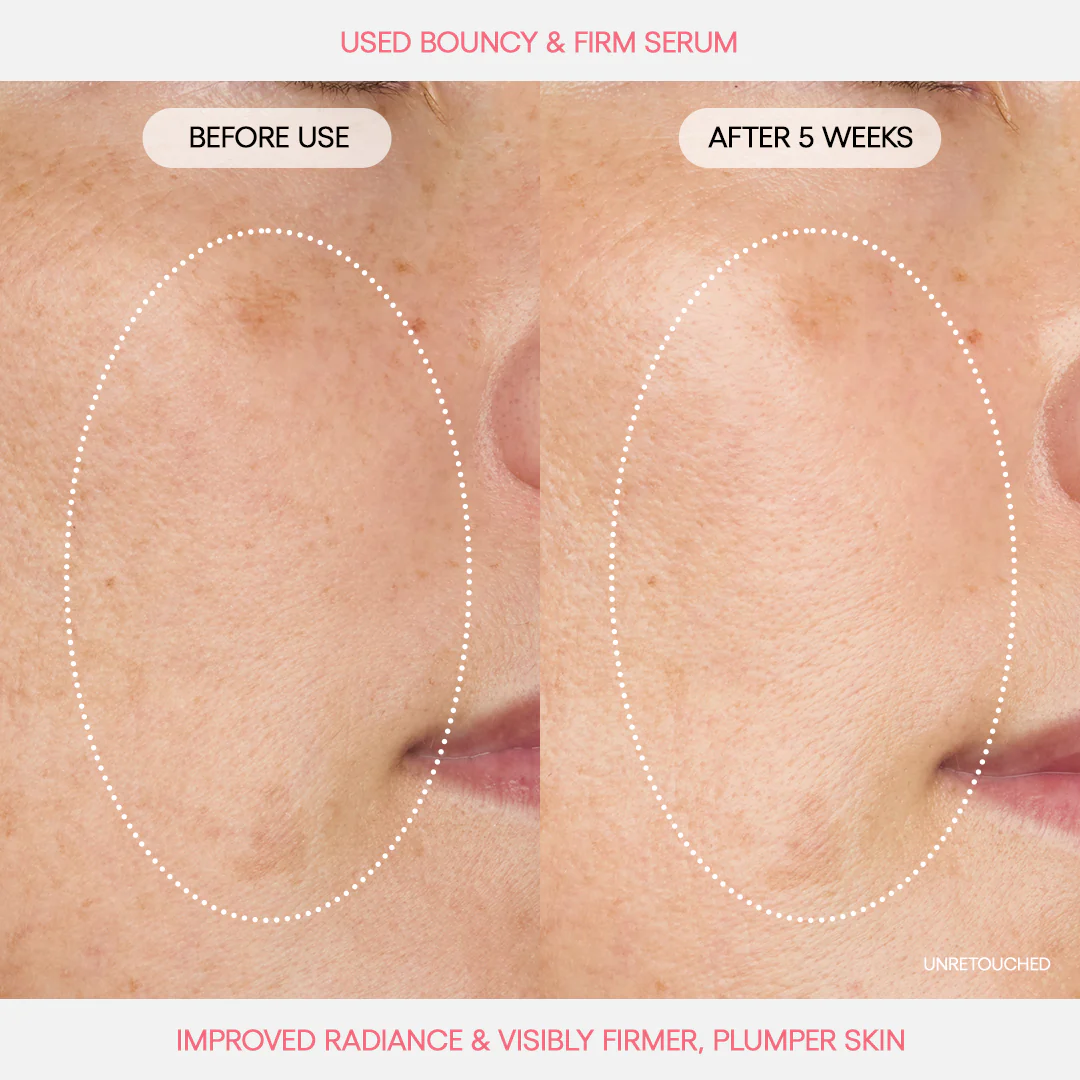 Bouncy & Firm Serum - Image 3